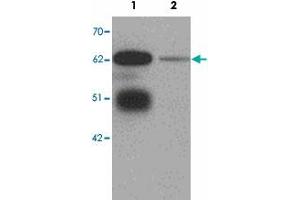 Western blot analysis of LRRTM3 in mouse brain tissue lysate with LRRTM3 polyclonal antibody  at 0.