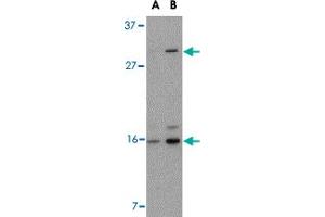 Western blot analysis of DRAM in 293 cell lysate with DRAM polyclonal antibody  at (A) 0. (DRAM Antikörper  (C-Term))