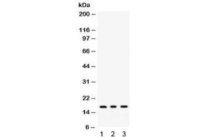 Western blot testing of 1) rat liver, 2) mouse liver, 3) human HepG2 lysate with MGST1 antibody. (MGST1 Antikörper)