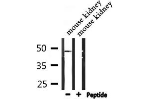 Western blot analysis of extracts from mouse kidney, using IP6K2 Antibody.