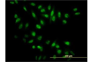 Immunofluorescence of monoclonal antibody to NR0B1 on HeLa cell. (NR0B1 Antikörper  (AA 361-470))