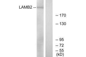 Western blot analysis of extracts from RAW264. (LAMB2 Antikörper)