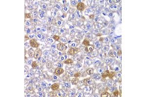 Immunohistochemistry of paraffin-embedded mouse liver using MYO1C antibody at dilution of 1:100 (x40 lens). (Myosin IC Antikörper)