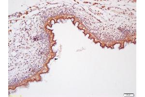 Immunohistochemistry (IHC) image for anti-Wingless-Type MMTV Integration Site Family, Member 11 (WNT11) (AA 151-250) antibody (ABIN1387554)