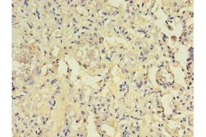 Immunohistochemistry of paraffin-embedded human lung tissue using ABIN7144554 at dilution of 1:100 (ACAP1 Antikörper  (AA 1-266))