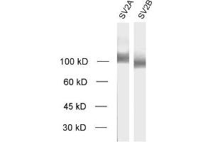 dilution: 1 : 1000, sample: crude synaptic vesicle fraction of rat brain (LP2) (SV2A Antikörper  (AA 2-17))