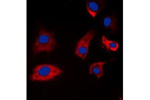 Immunofluorescent analysis of Synapsin 1 (pS9) staining in A549 cells. (SYN1 Antikörper  (N-Term, pSer9))