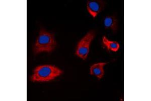 Immunofluorescent analysis of Synapsin 1 (pS9) staining in A549 cells.
