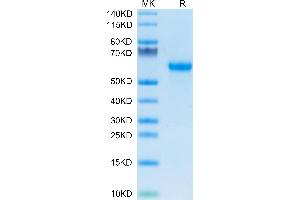 Complement Factor H Protein (CFH) (AA 875-1252) (His tag)