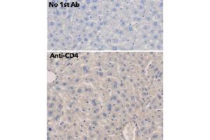 Immunohistochemistry (IHC) image for anti-CD4 (CD4) antibody (ABIN6254232)