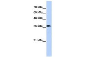 Image no. 1 for anti-ATPase, H+ Transporting, Lysosomal 38kDa, V0 Subunit D2 (ATP6V0D2) (C-Term) antibody (ABIN6741341) (ATP6V0D2 Antikörper  (C-Term))