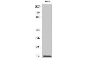Western Blotting (WB) image for anti-Stathmin 1 (STMN1) (Ser729) antibody (ABIN3186213) (Stathmin 1 Antikörper  (Ser729))