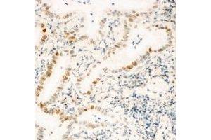 Immunohistochemical analysis of ZNF596 staining in human kidney formalin fixed paraffin embedded tissue section. (ZNF596 Antikörper)