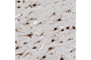 Immunohistochemical staining of human hippocampus with LBH polyclonal antibody  shows strong nuclear positivity in neuronal cells. (LBH Antikörper)