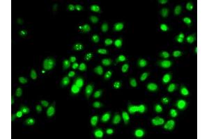 Immunofluorescence analysis of HeLa cells using TP53 antibody (ABIN5999084). (p53 Antikörper)
