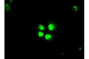 Anti-SATB1 mouse monoclonal antibody (ABIN2452628) immunofluorescent staining of COS7 cells transiently transfected by pCMV6-ENTRY SATB1 (RC200421). (SATB1 Antikörper)