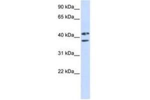 Image no. 1 for anti-Zinc Finger Protein 265 (Zranb2) (AA 144-193) antibody (ABIN6743051) (ZNF265 Antikörper  (AA 144-193))