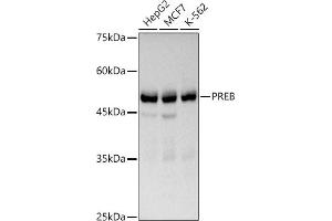 Western blot analysis of extracts of various cell lines, using PREB antibody (ABIN7269547) at 1:1000 dilution. (PREB Antikörper)