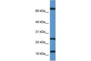 Image no. 1 for anti-TCR gamma Alternate Reading Frame Protein (TARP) (AA 7-56) antibody (ABIN6746905) (TARP Antikörper  (AA 7-56))