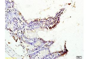Formalin-fixed and paraffin embedded rat colon tissue labeled with Anti-CDX2/3 Polyclonal Antibody, Unconjugated (ABIN1387257) at 1:200 followed by conjugation to the secondary antibody (CDX2+3 (AA 151-260) Antikörper)
