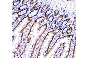 IHC analysis of HAUSP/USP7 using anti-HAUSP/USP7 antibody (ABIN6719603). (USP7 Antikörper  (AA 258-483))