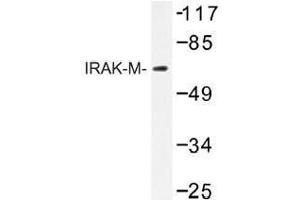 Image no. 1 for anti-Interleukin-1 Receptor-Associated Kinase 3 (IRAK3) antibody (ABIN317722)