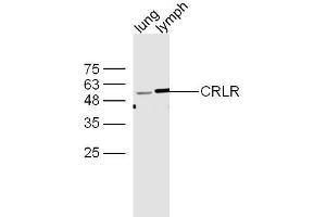 Mouse lung and lymph node lysates probed with Rabbit Anti-CRLR/CGRPR1 Polyclonal Antibody, Unconjugated  at 1:500 for 90 min at 37˚C.