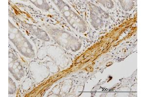 Immunoperoxidase of monoclonal antibody to CNN1 on formalin-fixed paraffin-embedded human small Intestine.