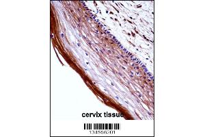 PGF Antibody immunohistochemistry analysis in formalin fixed and paraffin embedded human cervix tissue followed by peroxidase conjugation of the secondary antibody and DAB staining. (PLGF Antikörper  (AA 120-148))