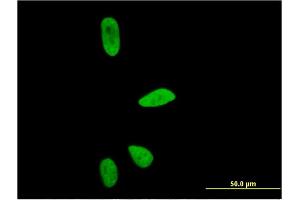 Immunofluorescence of monoclonal antibody to CD3EAP on HeLa cell. (CD3EAP Antikörper  (AA 2-110))