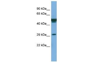 Host:  Rabbit  Target Name:  FAM3B  Sample Type:  PANC1 Whole cell lysates  Antibody Dilution:  1. (FAM3B Antikörper  (Middle Region))