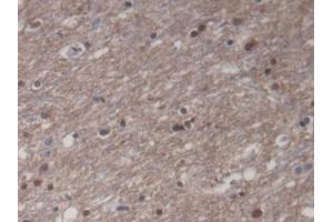 DAB staining on IHC-P; Samples: Human Cerebrum Tissue (CKM Antikörper)
