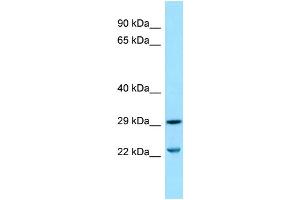 Western Blotting (WB) image for anti-Solute Carrier Family 25 (Mitochondrial Carrier, Dicarboxylate Transporter), Member 10 (SLC25A10) (Middle Region) antibody (ABIN2774446)