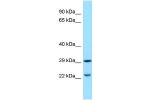 WB Suggested Anti-SLC25A10 Antibody Titration: 1. (SLC25A10 Antikörper  (Middle Region))