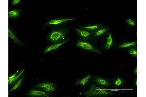 Immunofluorescence (IF) image for anti-Aldo-Keto Reductase Family 1, Member B10 (Aldose Reductase) (AKR1B10) (AA 76-143) antibody (ABIN528059)