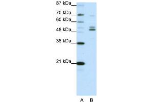 WB Suggested Anti-FOXA2 Antibody Titration:  0.
