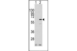 Image no. 1 for anti-ELK1, Member of ETS Oncogene Family (ELK1) (Ser383) antibody (ABIN358791) (ELK1 Antikörper  (Ser383))