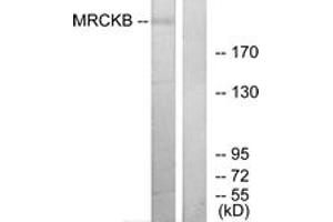 Western Blotting (WB) image for anti-CDC42 Binding Protein Kinase beta (DMPK-Like) (CDC42BPB) (AA 1641-1690) antibody (ABIN2879167) (CDC42BPB Antikörper  (AA 1641-1690))
