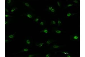 Immunofluorescence of monoclonal antibody to PLRG1 on HeLa cell. (PLRG1 Antikörper  (AA 101-198))
