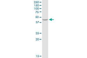 Western Blotting (WB) image for anti-Adenosine Deaminase (ADA) (AA 1-363) antibody (ABIN513110)