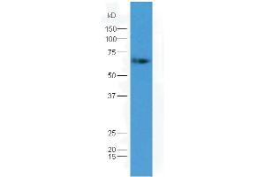 Lane 1: mouse embryo lysates probed with Rabbit Anti-GAD65 + GAD67 Polyclonal Antibody, Unconjugated (ABIN1714177) at 1:300 overnight at 4 °C. (GAD65+GAD67 (AA 351-450) Antikörper)