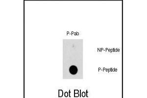 Dot blot analysis of Phospho-HSBP1-S78 polyclonal antibody (ABIN389744 and ABIN2839677) on nitrocellulose membrane.