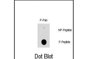 Dot blot analysis of Phospho-HSBP1-S78 polyclonal antibody (ABIN389744 and ABIN2839677) on nitrocellulose membrane. (HSP27 Antikörper  (pSer78))