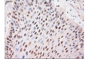 Immunohistochemical staining of paraffin-embedded kidney using anti-Stat4 (ABIN2452527) mouse monoclonal antibody. (STAT4 Antikörper  (AA 633-652))