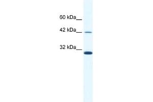 WB Suggested Anti-APOBEC3G Antibody   Titration: 2. (APOBEC3G Antikörper  (N-Term))