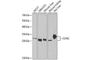 Western blot analysis of extracts of various cell lines using CCNC Polyclonal Antibody at dilution of 1:1000. (Cyclin C Antikörper)
