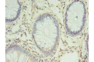 Immunohistochemistry (IHC) image for anti-Charged Multivesicular Body Protein 6 (CHMP6) (AA 2-201) antibody (ABIN7147533)