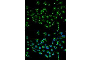 Immunofluorescence analysis of MCF-7 cells using CDKN3 antibody (ABIN5971092). (CDKN3 Antikörper)