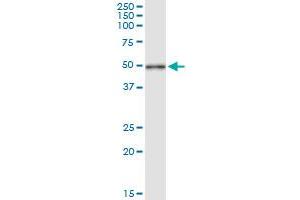 Immunoprecipitation of CYTH2 transfected lysate using anti-CYTH2 MaxPab rabbit polyclonal antibody and Protein A Magnetic Bead , and immunoblotted with CYTH2 MaxPab mouse polyclonal antibody (B01) . (Cytohesin 2 Antikörper  (AA 1-400))