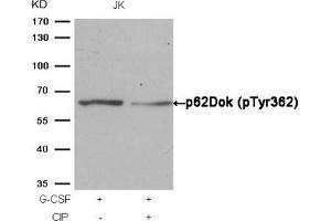 Western Blotting (WB) image for anti-Docking Protein 1, 62kDa (Downstream of tyrosine Kinase 1) (DOK1) (pTyr362) antibody (ABIN7138991)